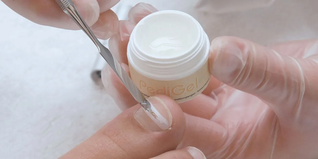 Gel applied to secure nail brace