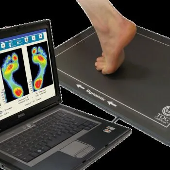 Client standing on a GaitScan pressure plate with results on a laptop